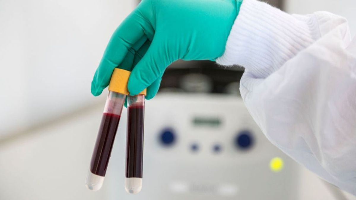 Científicos desarrollan un análisis de sangre para detectar el Alzheimer: "Es barato, seguro y fácil de administrar"