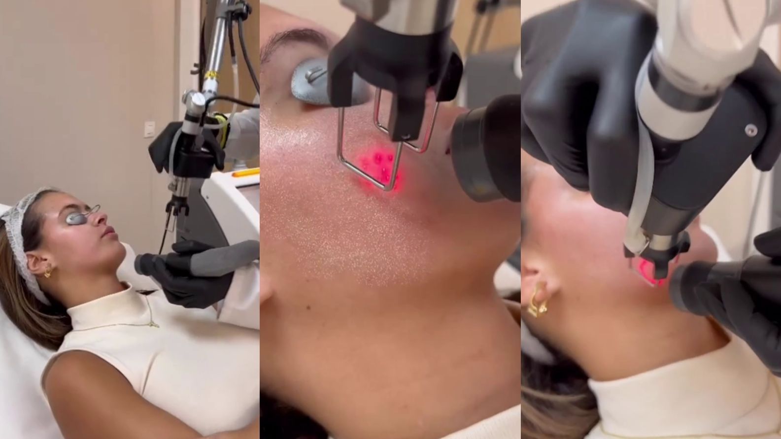 Tania Déniz acude a una clínica de medicina estética para tratar su problema con el acné