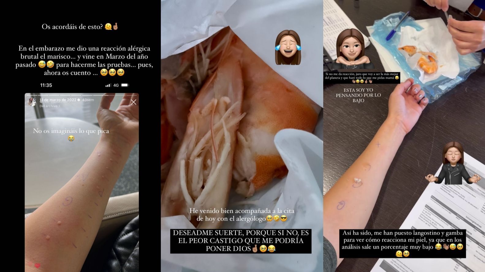 Laura Matamoros tiene alergia al marisco