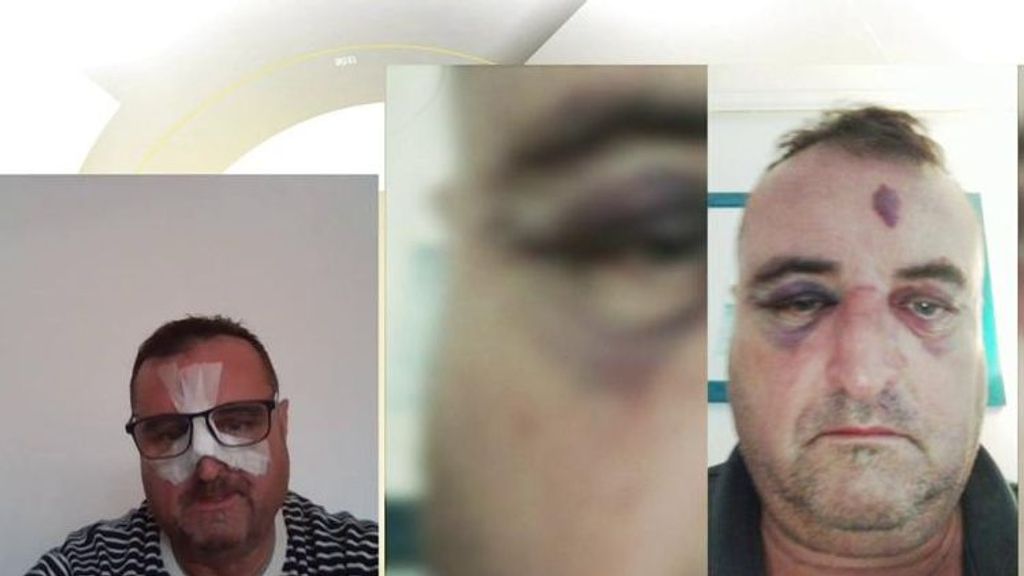 Técnico de ambulancia agredido: "Además del paciente, sus padres también me pegaron y me mordieron"