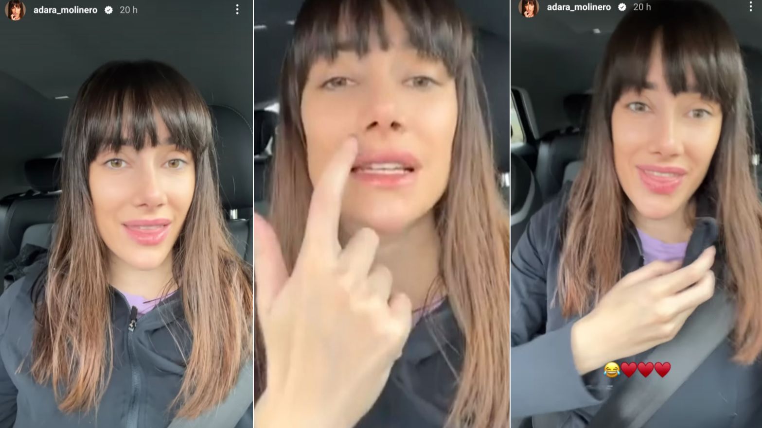 Adara Molinero explica por qué su nariz se ve a veces diferente