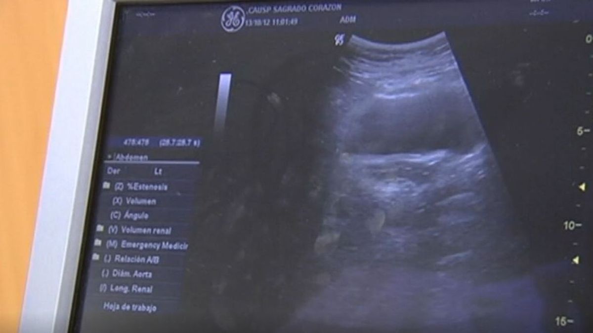 Las ecografías ya están en el paquete de servicios que ofrece la sanidad pública española a mujeres embarazadas.