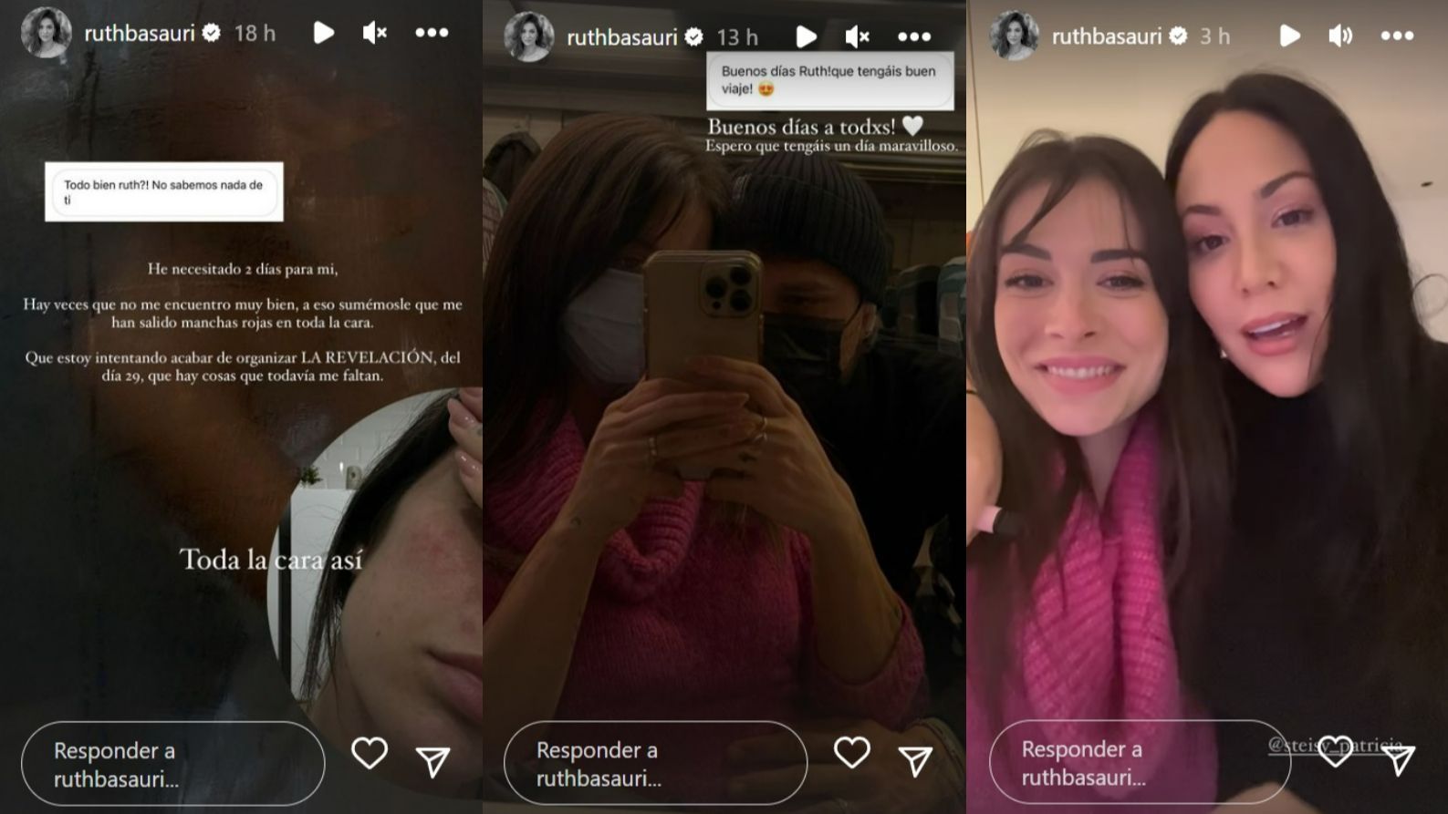 Ruth Basauri explica cómo se encuentra y habla de su reencuentro con Patricia Steisy