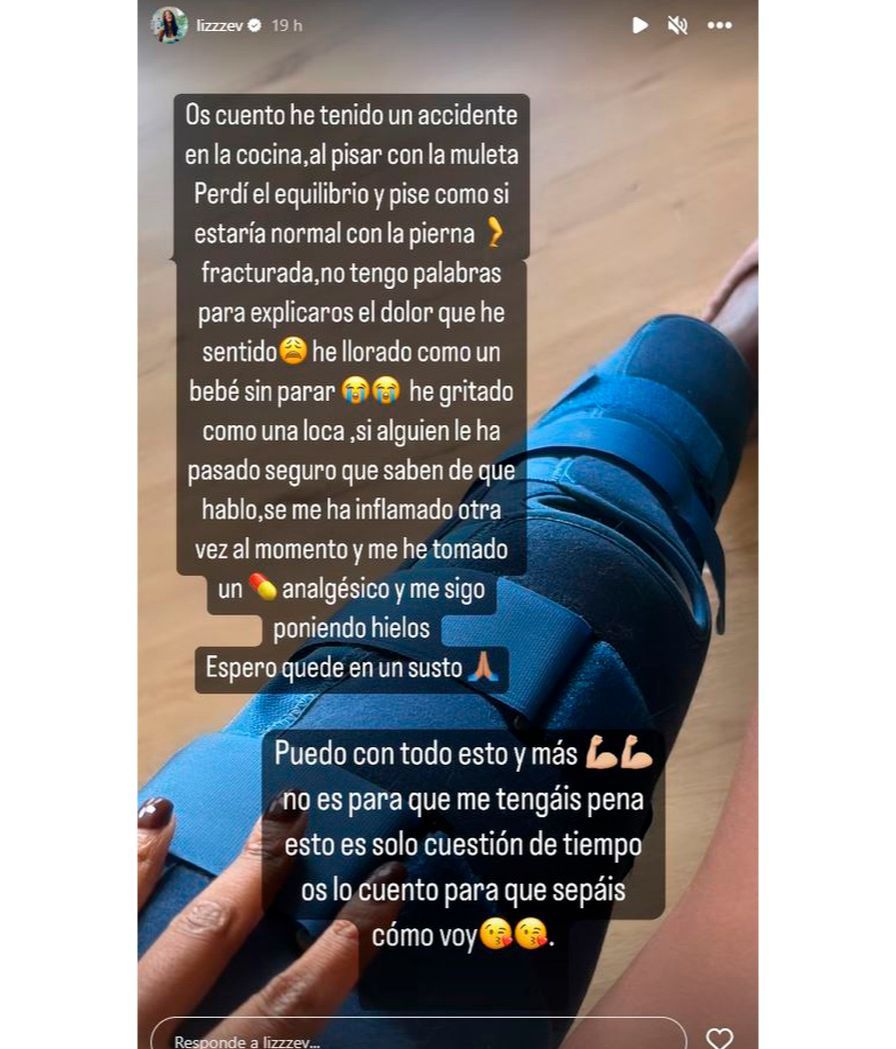 Liz Emiliano explica el accidente doméstico que ha tenido con su pierna fracturada