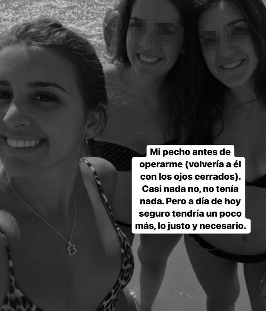 Así era Marina García sin el pecho operado