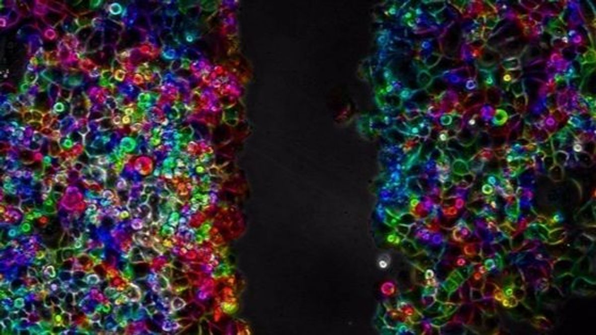 Células de cáncer de páncreas PANC-1 durante un proceso de migración celular