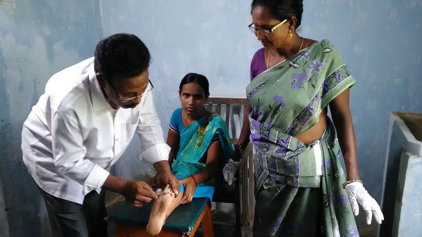 Niña con lepra atendida por un médico