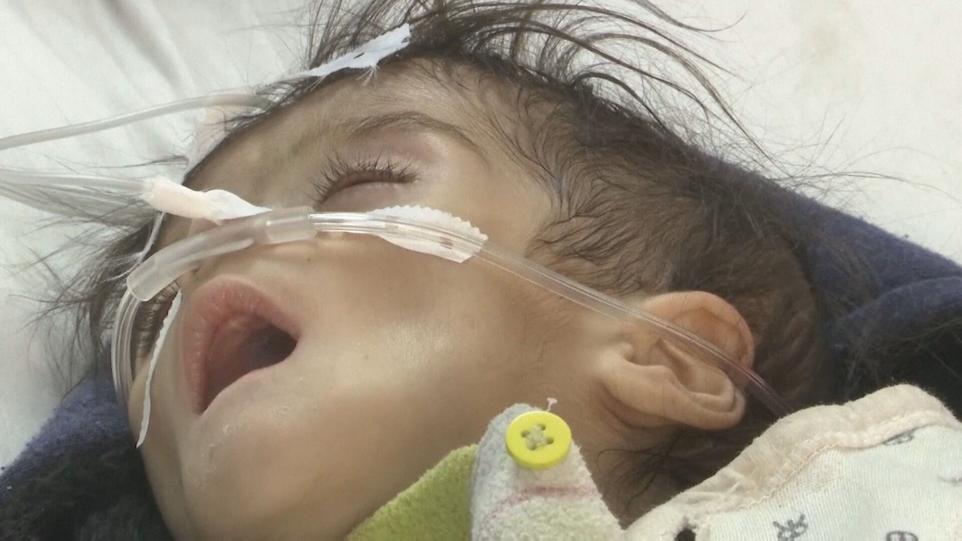 Hambre infantil en Afganistán