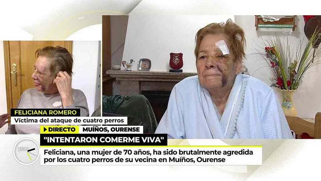Una mujer de 70 sobrevive al brutal ataque de 4 perros de raza peligrosa en Muíños, Ourense