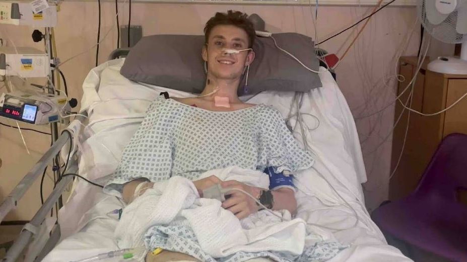 Levi Dewey, el joven de 21 años llegó con una gripe que derivó en una sepsis por lo que le han amputado ambas piernas