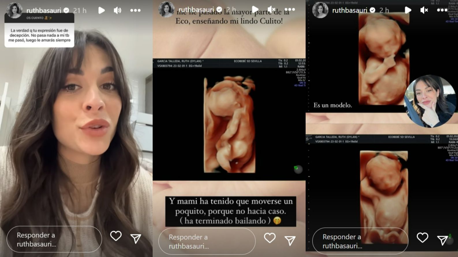 Ruth Basauri muestra la ecografía 5D de su bebé