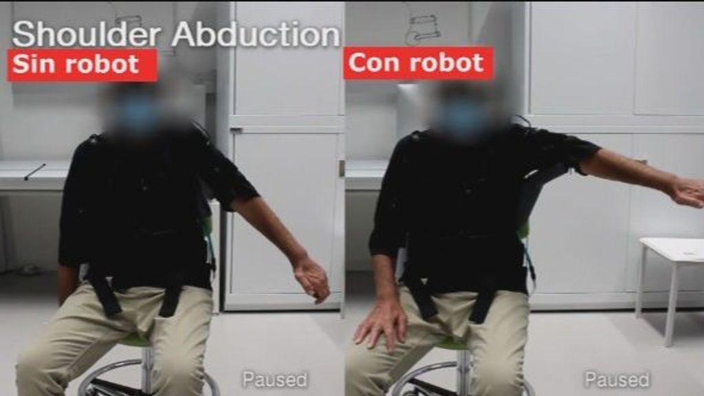Científicos de Harvard diseñan un brazo robótico para mejorar la movilidad de enfermos de ELA