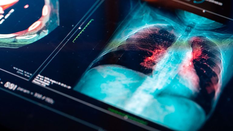 ¿Se pueden heredar el cáncer?