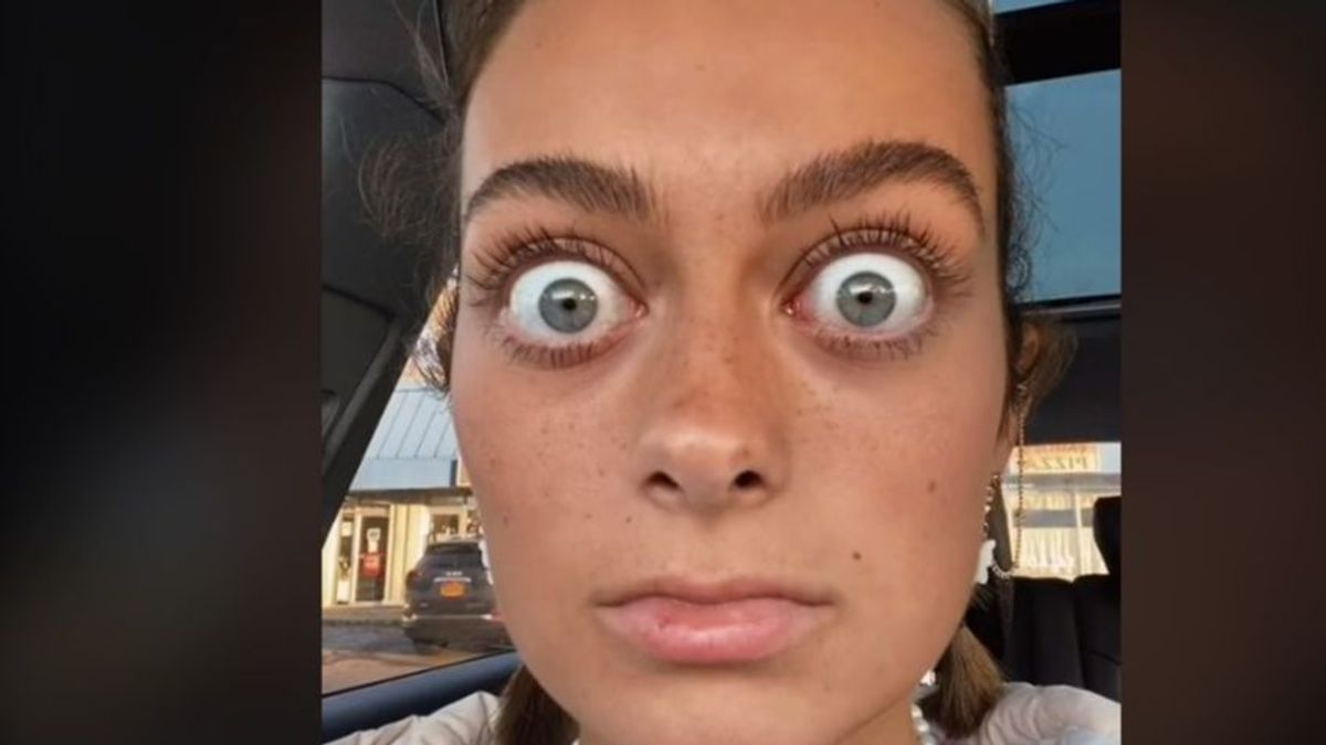 La joven viral en TikTok por sus ojos desorbitados: "Parece Gollum"