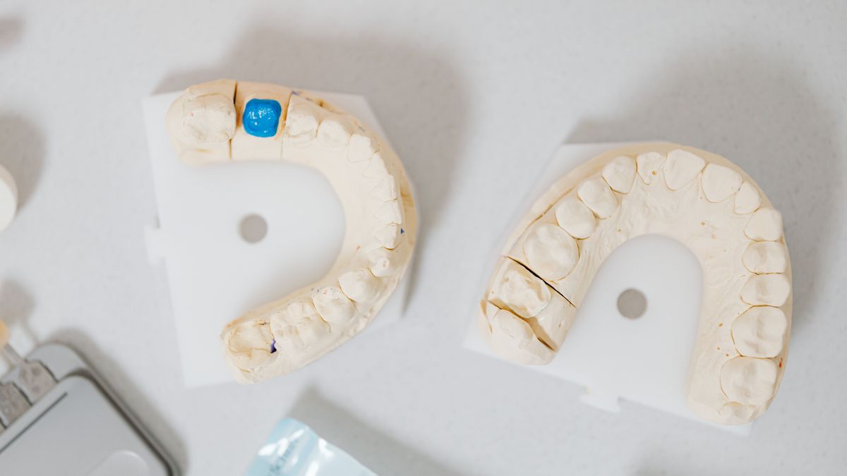 Ortodoncia más allá de los 50: ¿es recomendable?