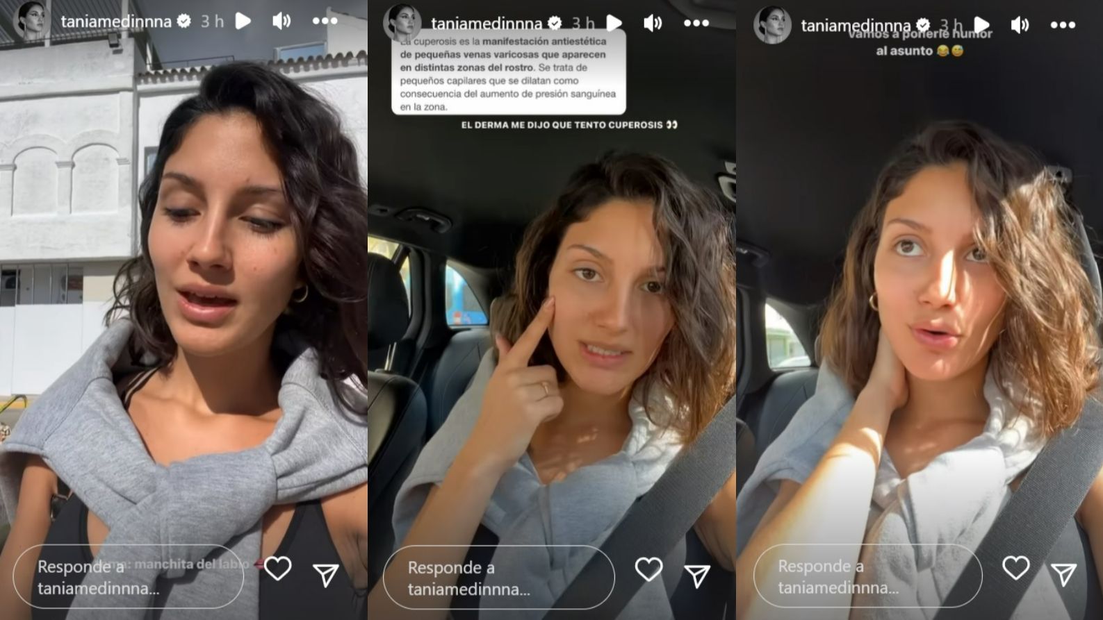 Tania Medina habla de sus problemas dermatológicos