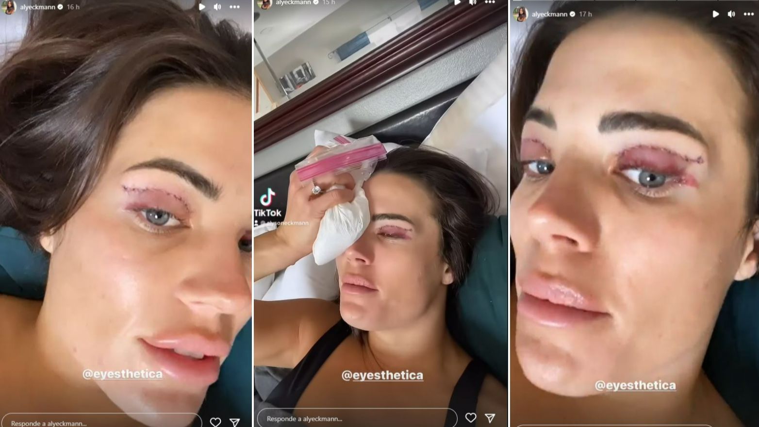 Alyson Eckmann actualiza su estado de salud tras su operación de ojos -  Pesadilla en el paraíso