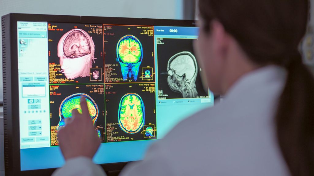 Pruebas diagnosticas por TAC y escáner para detectar problemas neurológicos como el alzhéimer
