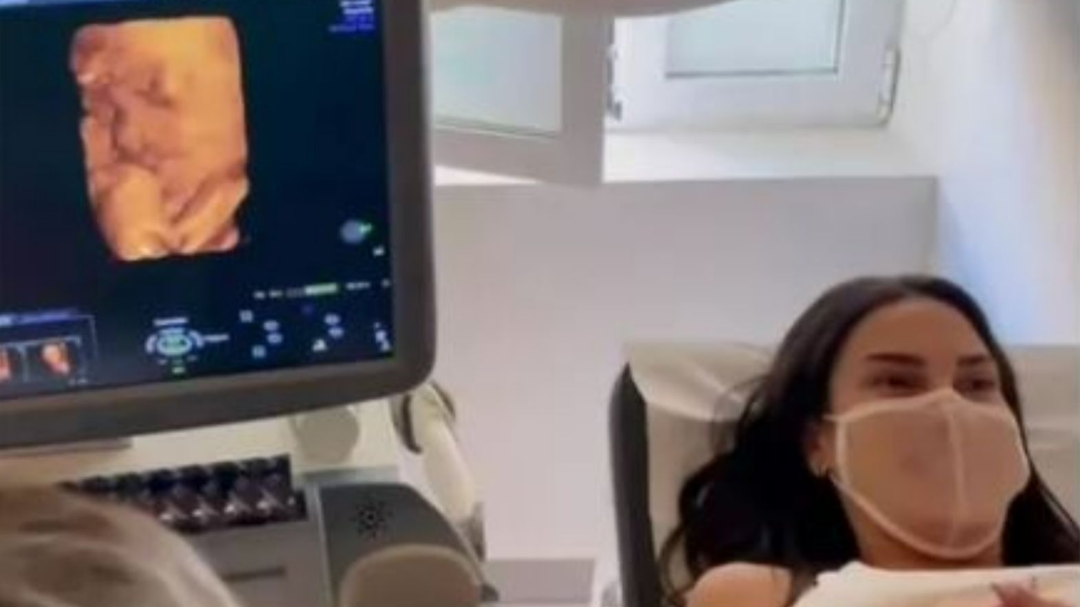 Carla Barber enseña la cara de Romeo, su segundo hijo