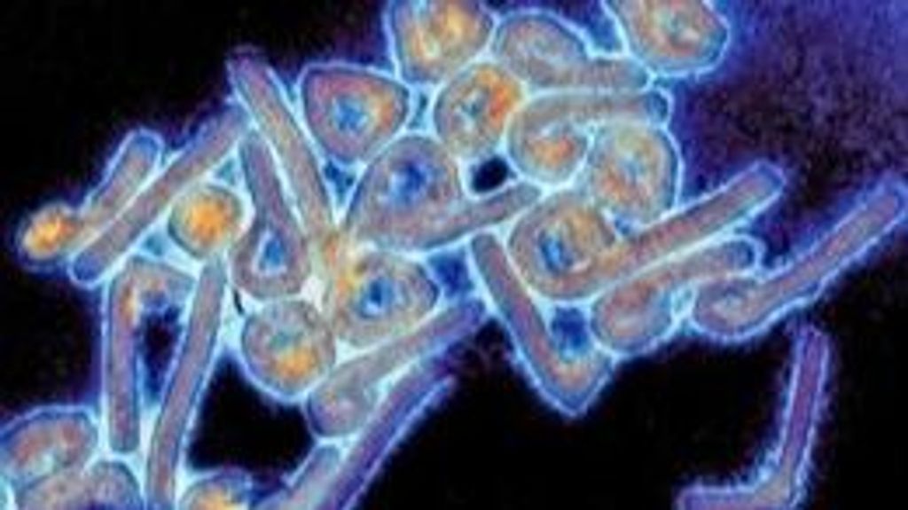 Guinea Ecuatorial declara la alerta sanitaria tras confirmar un brote de virus de Marburgo