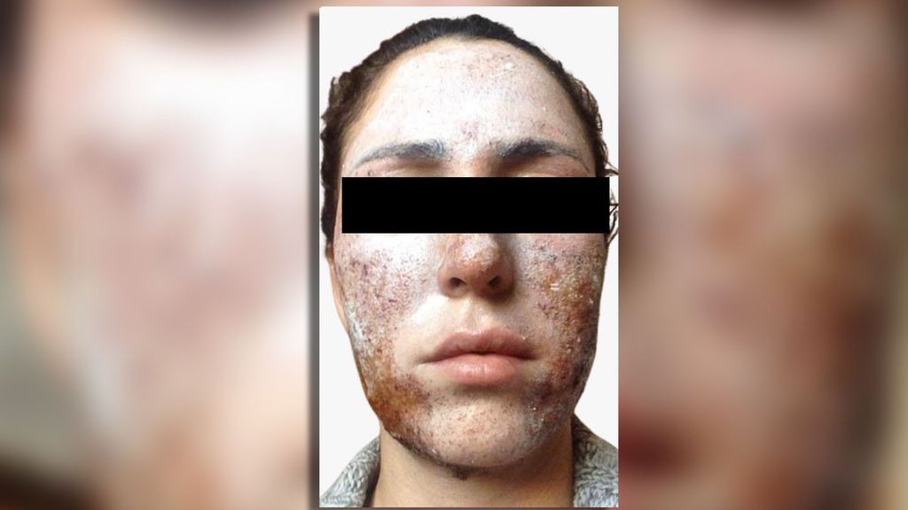 La 'clínica del terror' denunciada en Marbella llevaría años actuando así: “Hace 9 que me destrozó la cara”