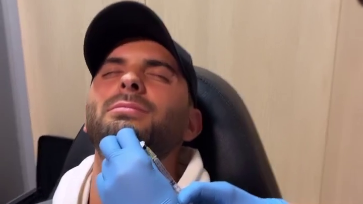 Suso Álvarez acude a una clínica para eliminar la calva de su barba