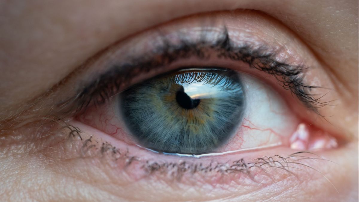 El glaucoma es la segunda causa de ceguera en España