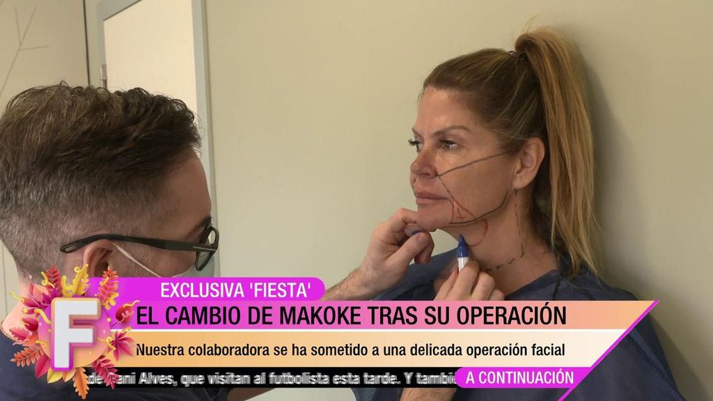 El previo a la operación de Makoke