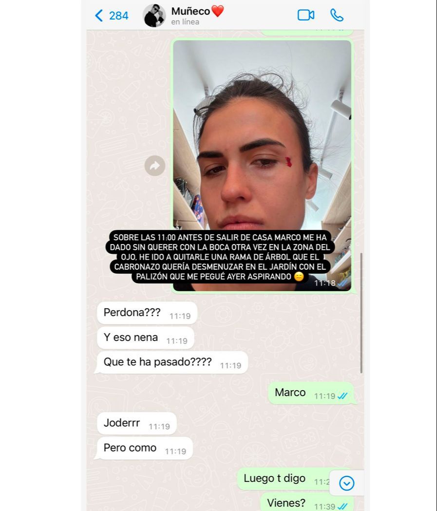 Sofía Suescun ha mostrado su herida en el rostro tras el percance con su perro