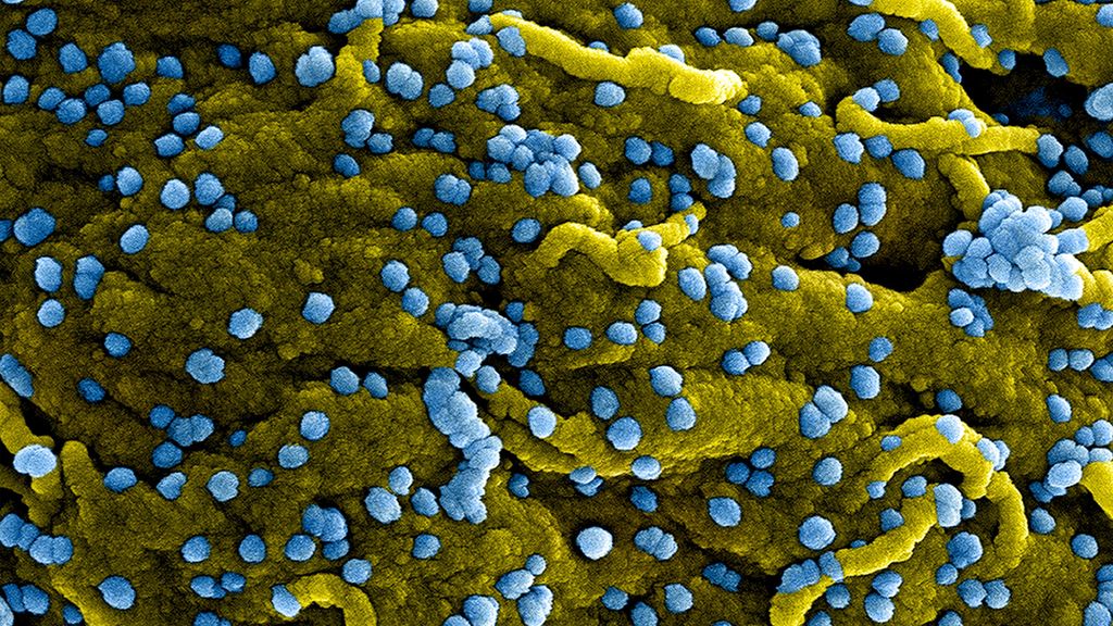 Vista microscópica del virus de Marburgo para el que el Ministerio de Sanidad ya ha elaborado un protocolo para la detección y manejo de casos