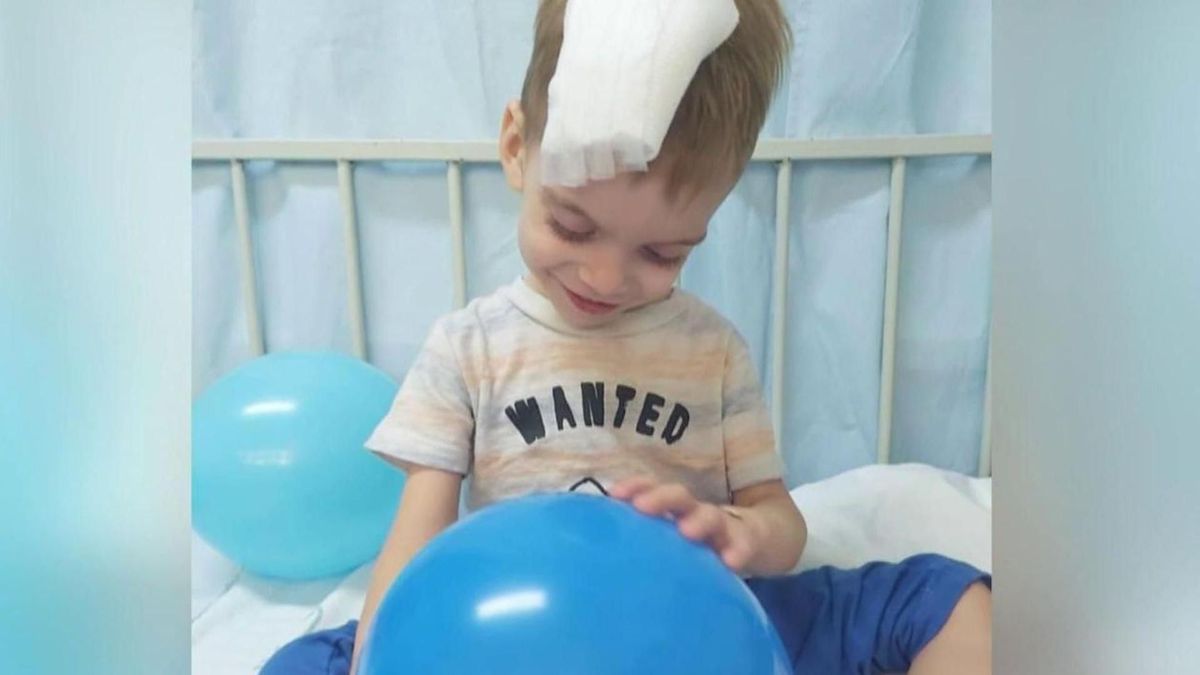 El pequeño Oliver se someterá hoy a una nueva operación para extirparle completamente su tumor cerebral