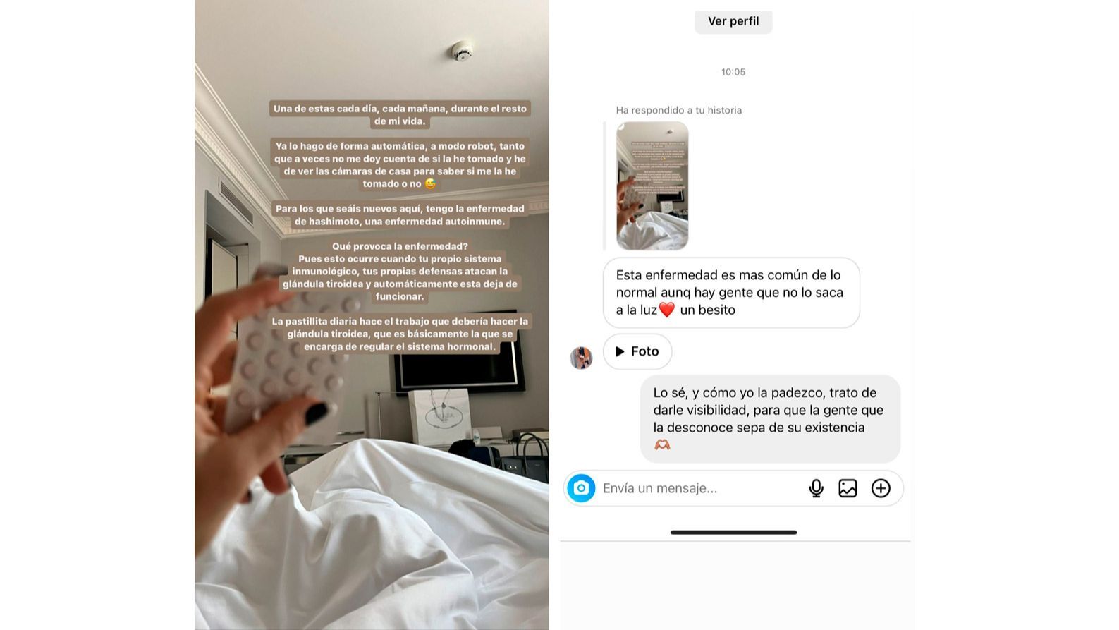 Violeta Mangriñán habla de su enfermedad autoinmune