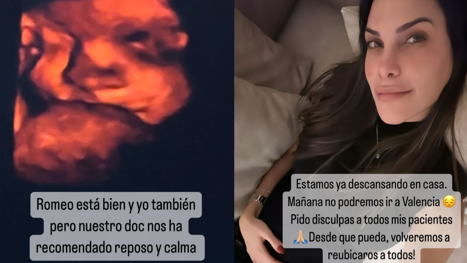 Carla Barber, obligada a guardar reposo por prescripción médica