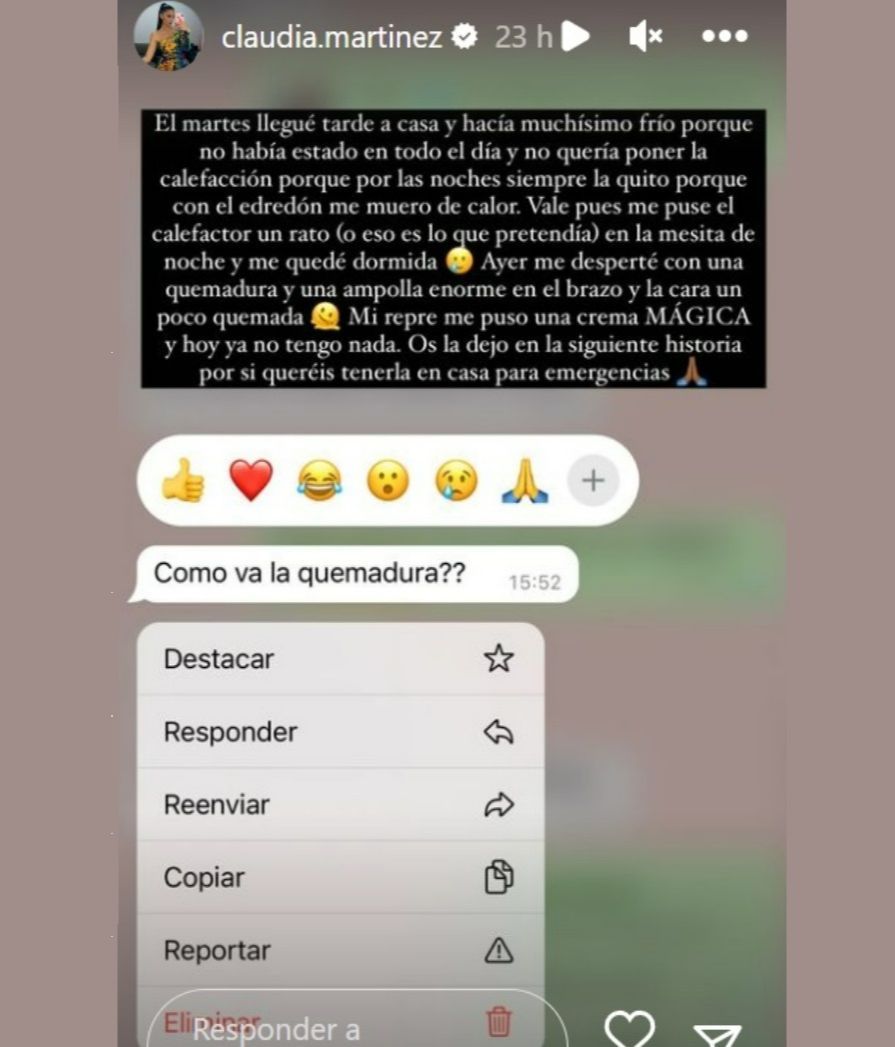 Claudia Martínez habla de su accidente doméstico