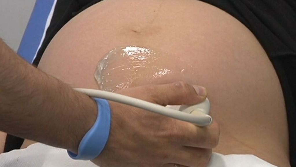 Los padres que donaron los órganos de su bebé fallecido siguieron tres meses con la gestación
