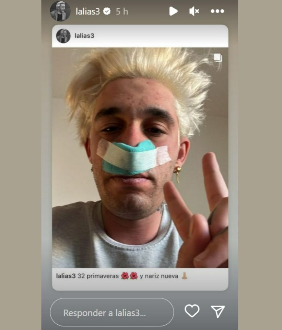 Víctor Elías cuenta que se ha operado la nariz