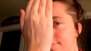 La historia de Trinity: un perro le desfiguró el rostro, tuvo que injertarse piel y ahora le crece pelo en la cara