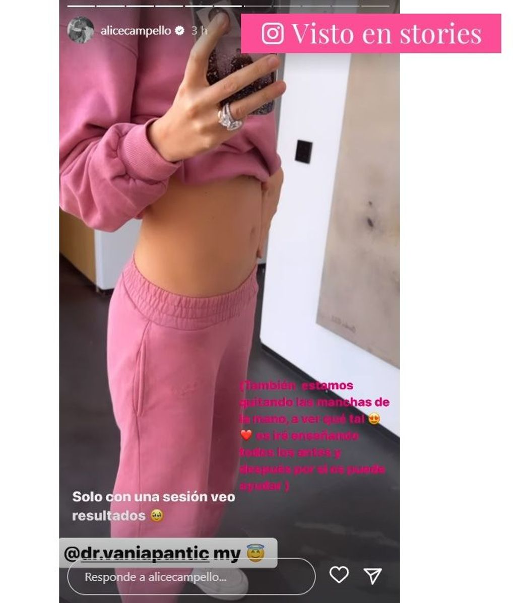 Alice Campello shares the image of her postpartum belly in full physical recovery