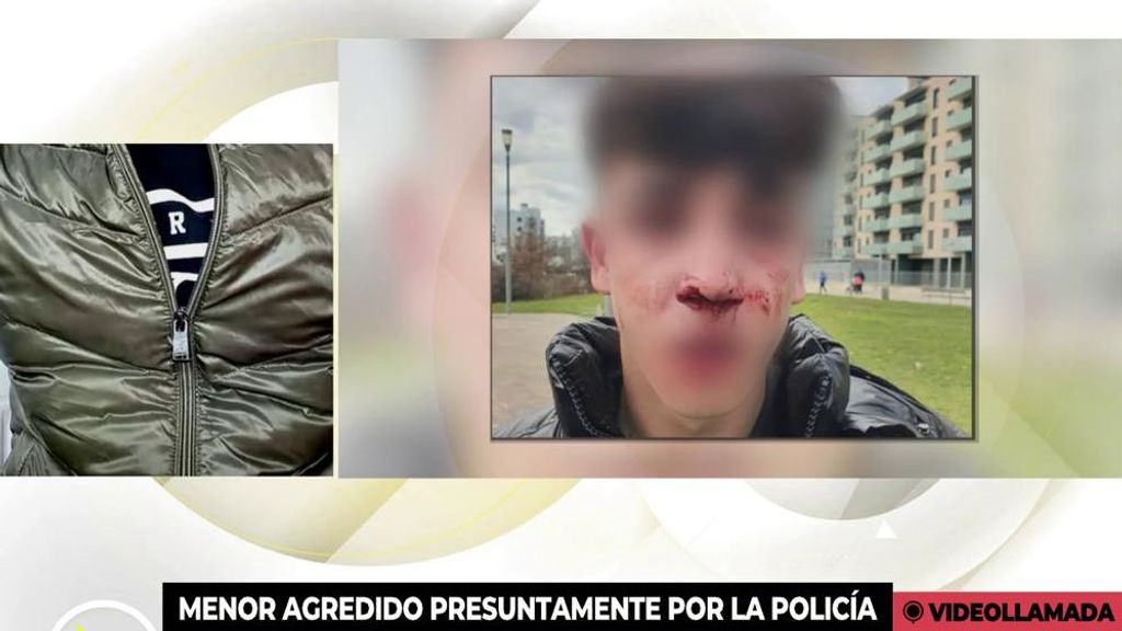 Habla el padre del menor agredido por la policía