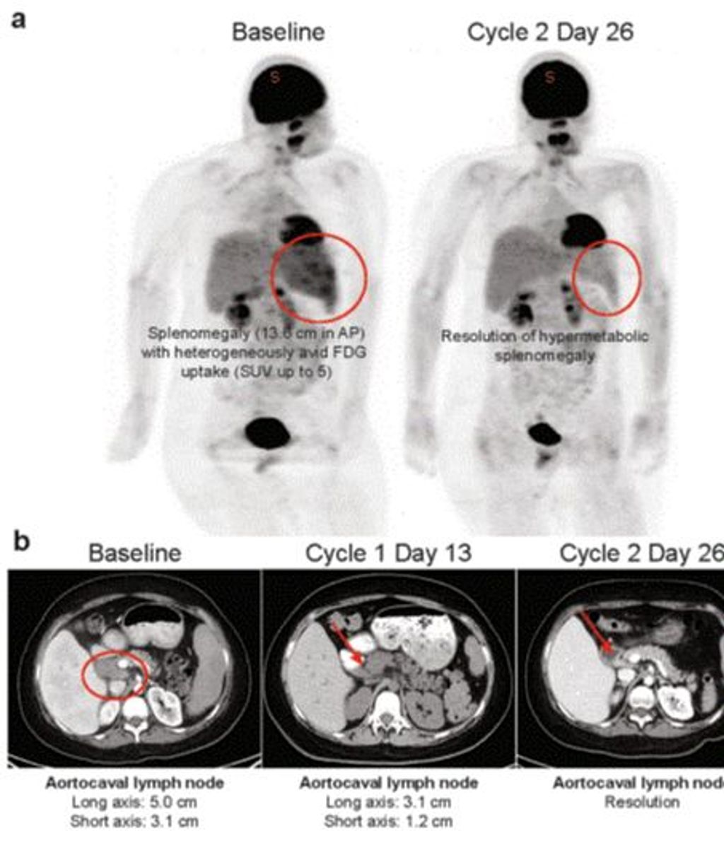 Pastilla experimental cura leucemia