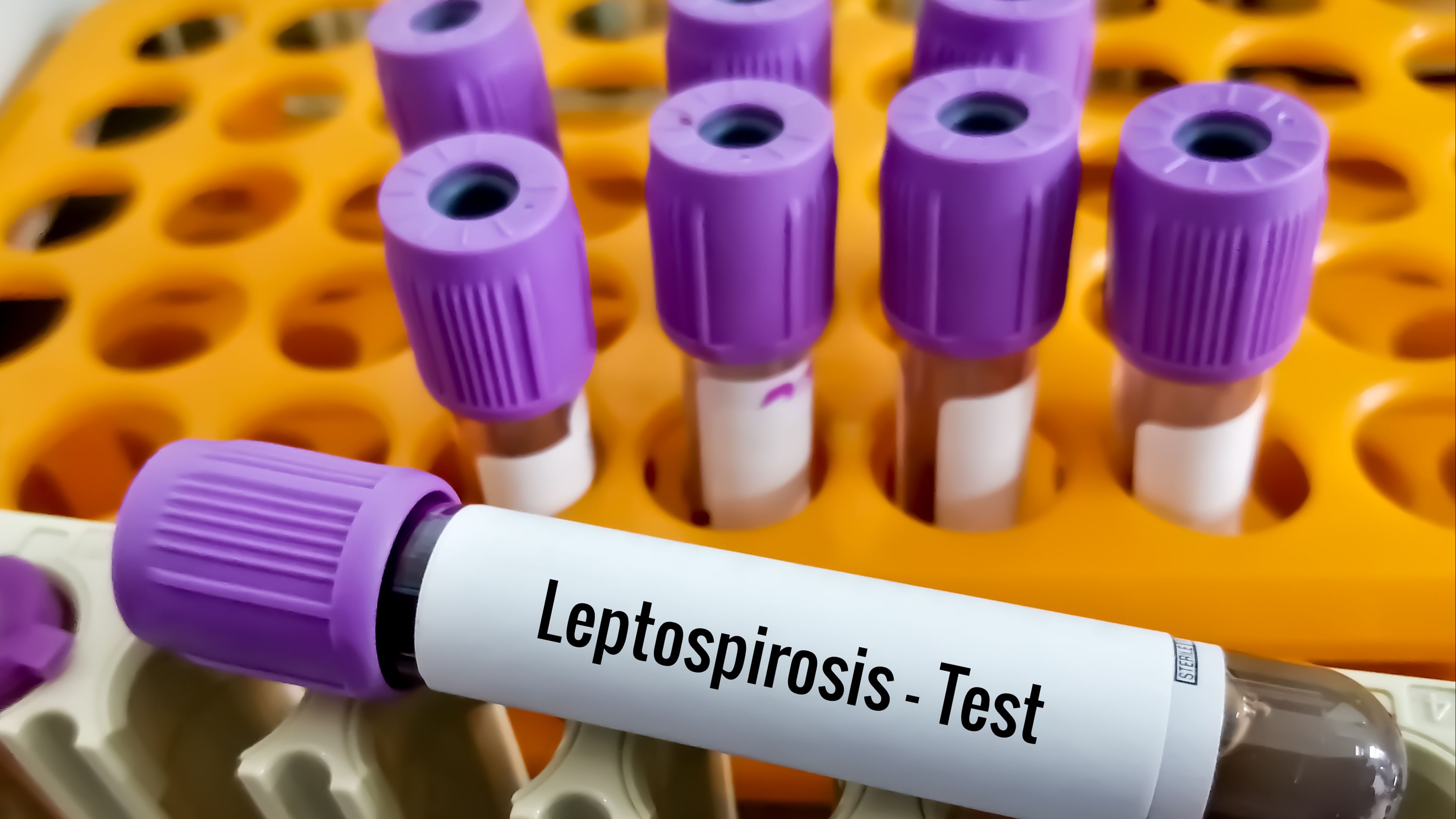 Leptospirosis