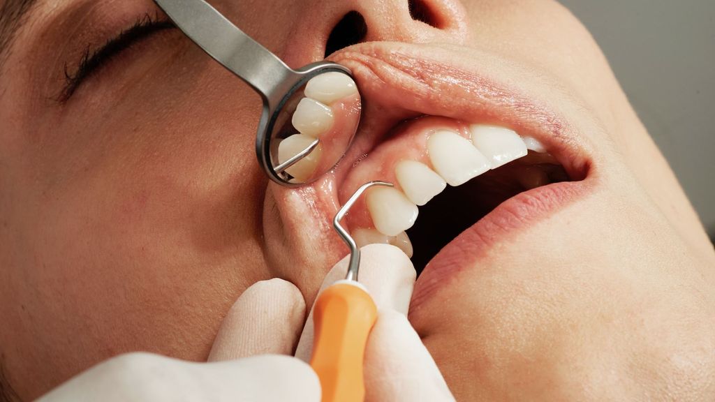 La salud dental puede verse afectada por la diabetes