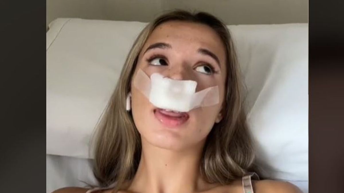 Se vuelve viral la razón por la que una 'tiktoker' decidió operarse la nariz