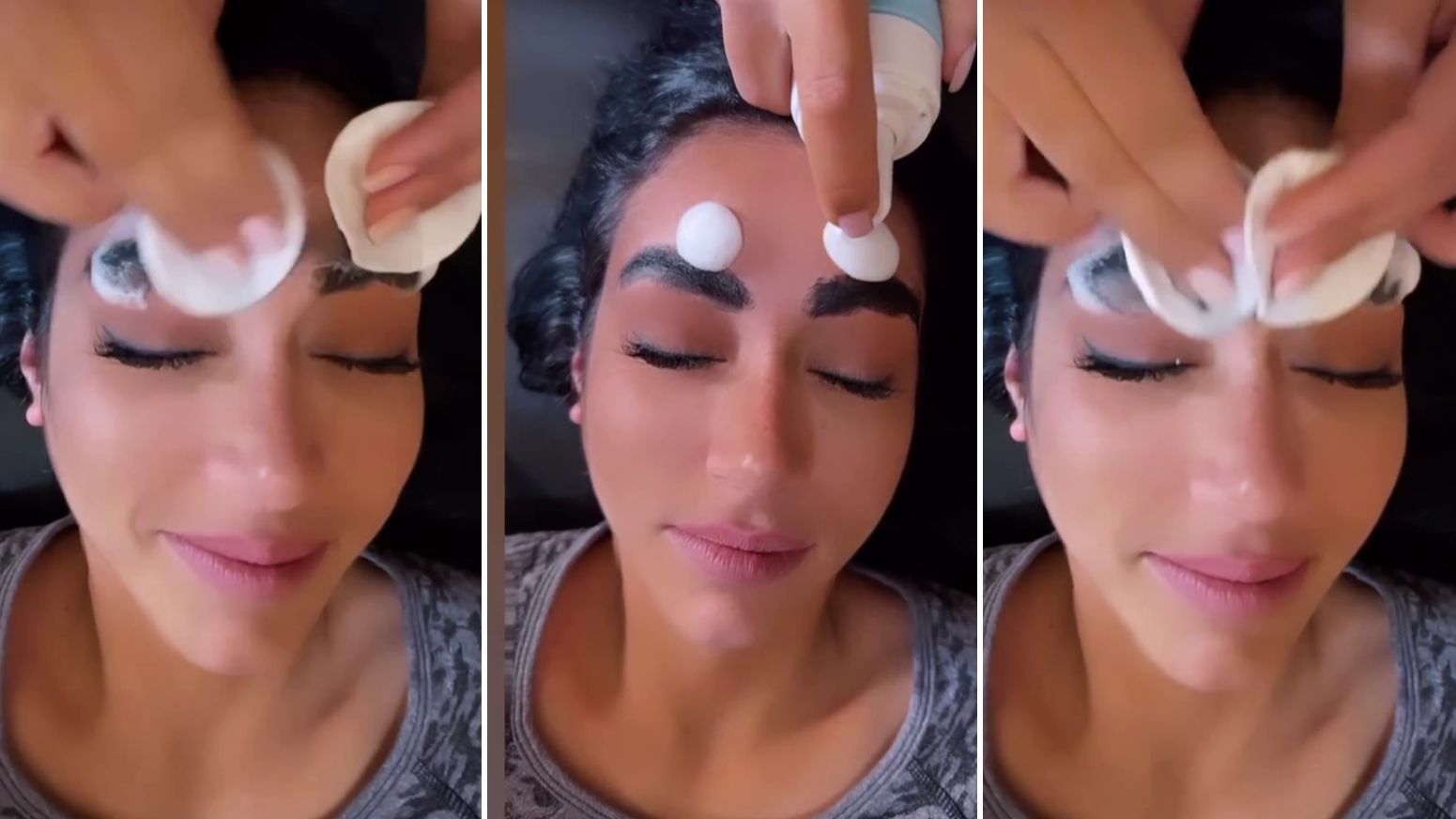 El antes y el después de Dakota Tárraga tras su último tratamiento estético facial