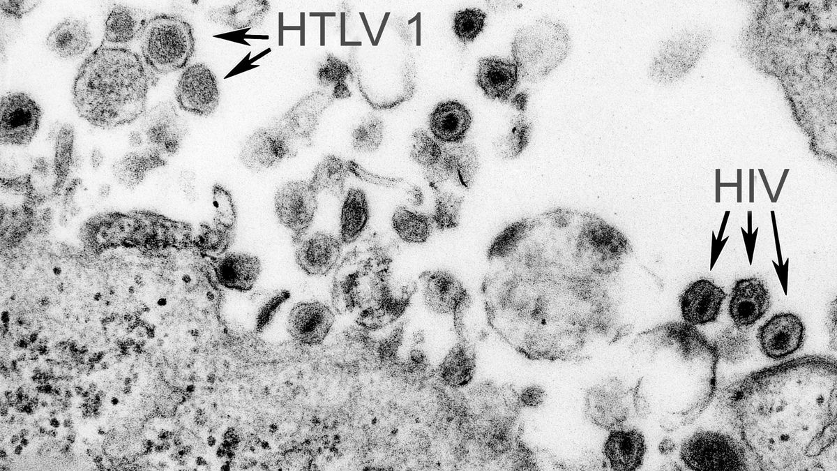 Desarrollan unas tijeras genéticas contra el virus HTLV-1, el 'hermano' del VIH