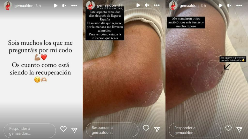 Gema Aldón actualiza su estado de salud