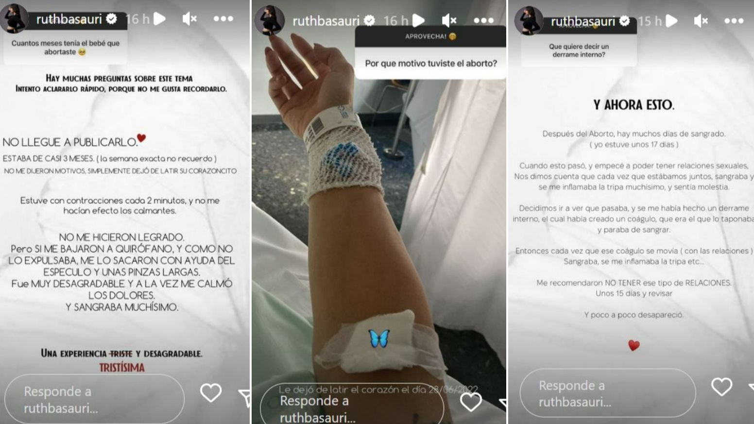 Ruth Basauri habla por primera vez del aborto que sufrió