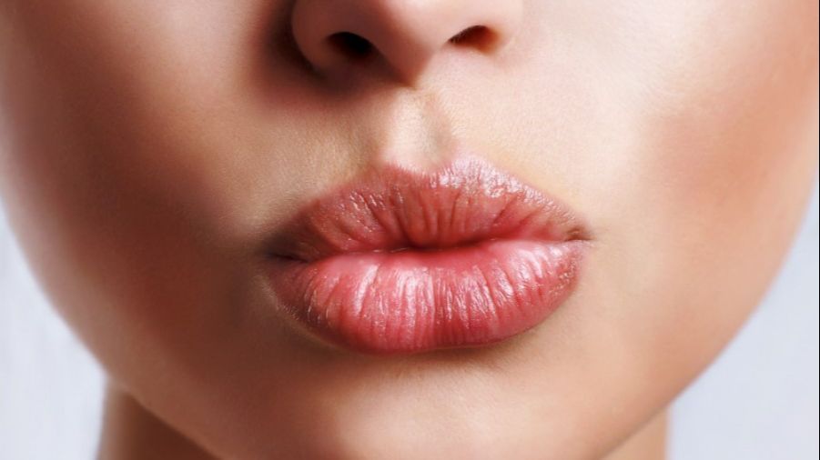 Labios