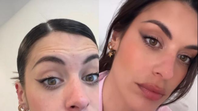 La influencer Dulceida se pone bótox en la frente