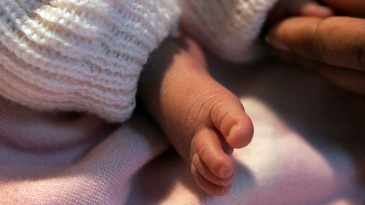 Fenómeno extraordinariamente raro en Pakistán: nace un bebé con dos penes que funcionan y sin ano